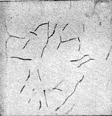 Granule Bacillus from Yoghourt, Cultivated after the Usual Agar Method