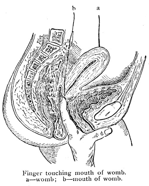 Finger touching mouth of womb.
a—womb; b—mouth of womb.