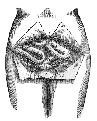 Front
View of the Female Pelvis