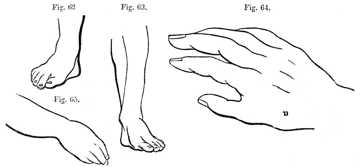 Four Drawing Figures 62 to 64